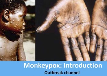 ‘Monkeypox’ spread over 78 countries! over 18,000 infected!