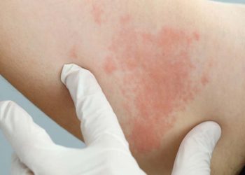 So far this year, the number of HIV-infected people has more than doubled.