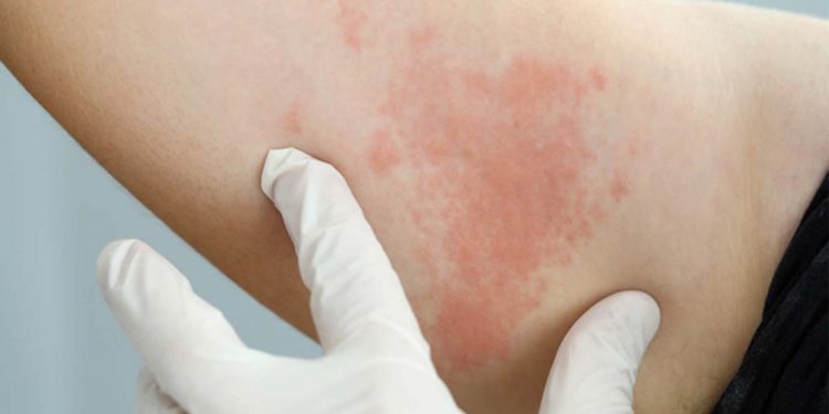 So far this year, the number of HIV-infected people has more than doubled.