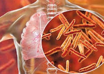 Tuberculosis is rapidly spreading.
