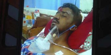 A boxing champion abducted, beaten, and burned!