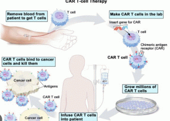 Advanced treatment for blood cancer now in Sri Lanka