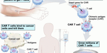 Advanced treatment for blood cancer now in Sri Lanka