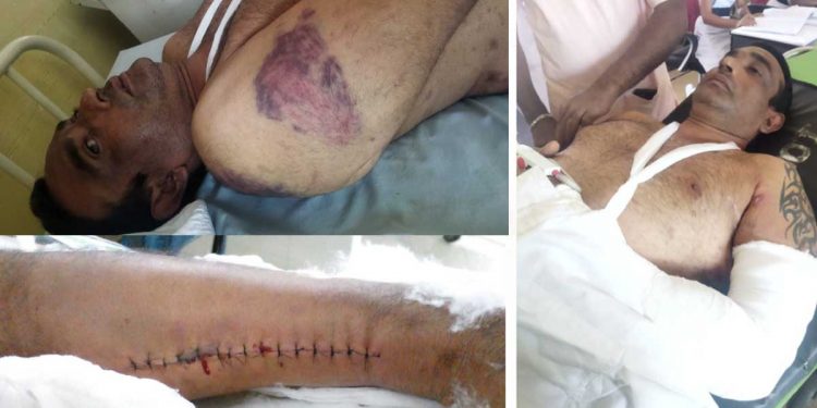 A brutal attack by the Grandpass police on a person! Bruises on every part of the body! An arm fracture! The leg has a two-foot seam! Applying pressure to withdraw the complaint!