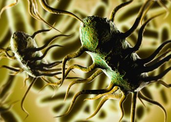A new disease has entered Sri Lanka! The disease is known as ‘Listeria’! The first patient died today!