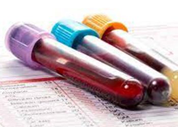 If you have symptoms, do not put off getting a blood test! It could be fatal! – A Medical warning!