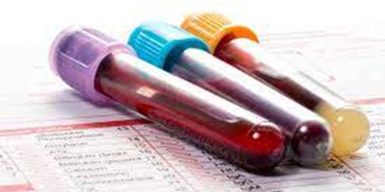 If you have symptoms, do not put off getting a blood test! It could be fatal! – A Medical warning!