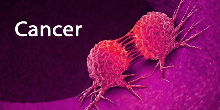 Cancer has become the second leading cause of death from non-communicable diseases in Sri Lanka- Report I Sri Lanka Latest News