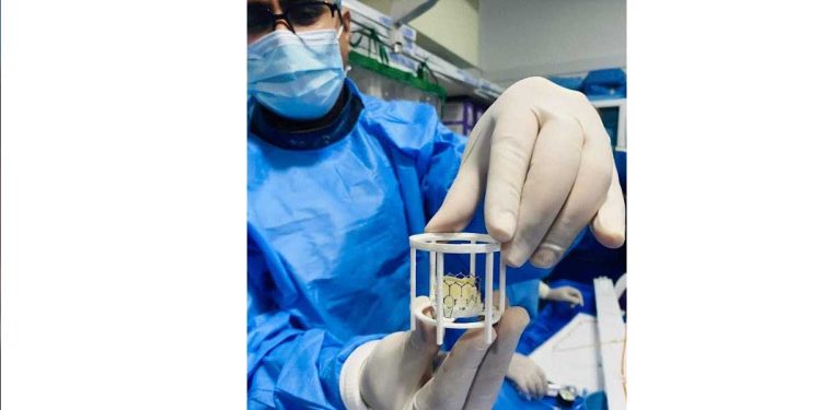 Complex lifesaving TAVI heart procedure for Aortic Valve Replacement successfully performed at Asiri Surgical Hospital  I Sri Lanka Latest Business News