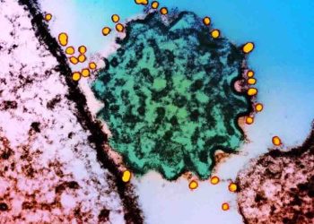 Nipah virus, spreading rapidly in India: currently no vaccine: threat to Sri Lanka? Bureau of Health Promotion! I Sri Lanka Latest News