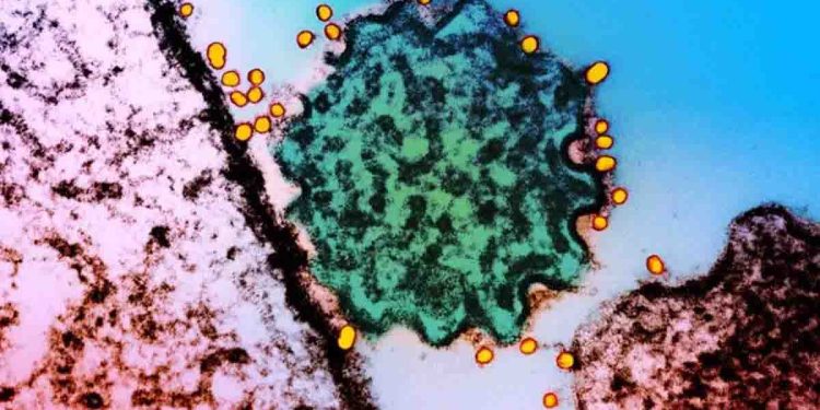Nipah virus, spreading rapidly in India: currently no vaccine: threat to Sri Lanka?  Bureau of Health Promotion! I Sri Lanka Latest News