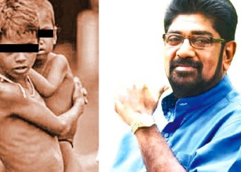 400 malnourished children grew up in just one province of Keheliya’s election district! 25 children suffer from acute malnutrition! Sri Lanka Latest News