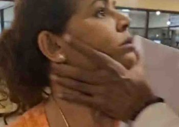 Did Diana get assaulted? Sujith smiled and replied to  journalists! VIDEO I Sri Lanka Latest News