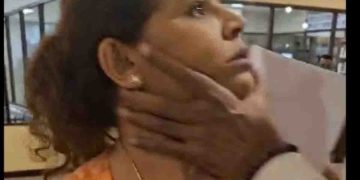 Did Diana get assaulted? Sujith smiled and replied to  journalists! VIDEO I Sri Lanka Latest News