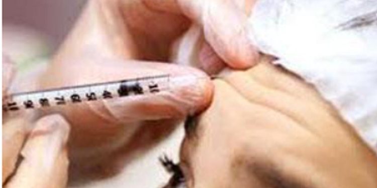 Unregistered Skin Treatment Medicines Sold as Cosmetics Pose Health Risks in Sri Lanka: NMRA and Dermatologists Launch Investigations