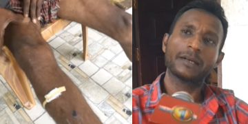Former Sri Lankan Navy Soldier Returns Home Severely Injured After Being Deceived by Human Traffickers and Fighting in Ukraine | Sri Lanka Latest News