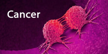 cancer